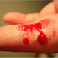 Blood Blood